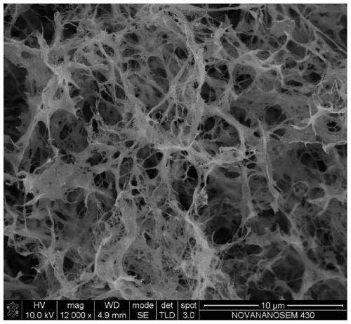 Chitosan/bacterial cellulose composite aerogel adsorbent and preparation method and application thereof