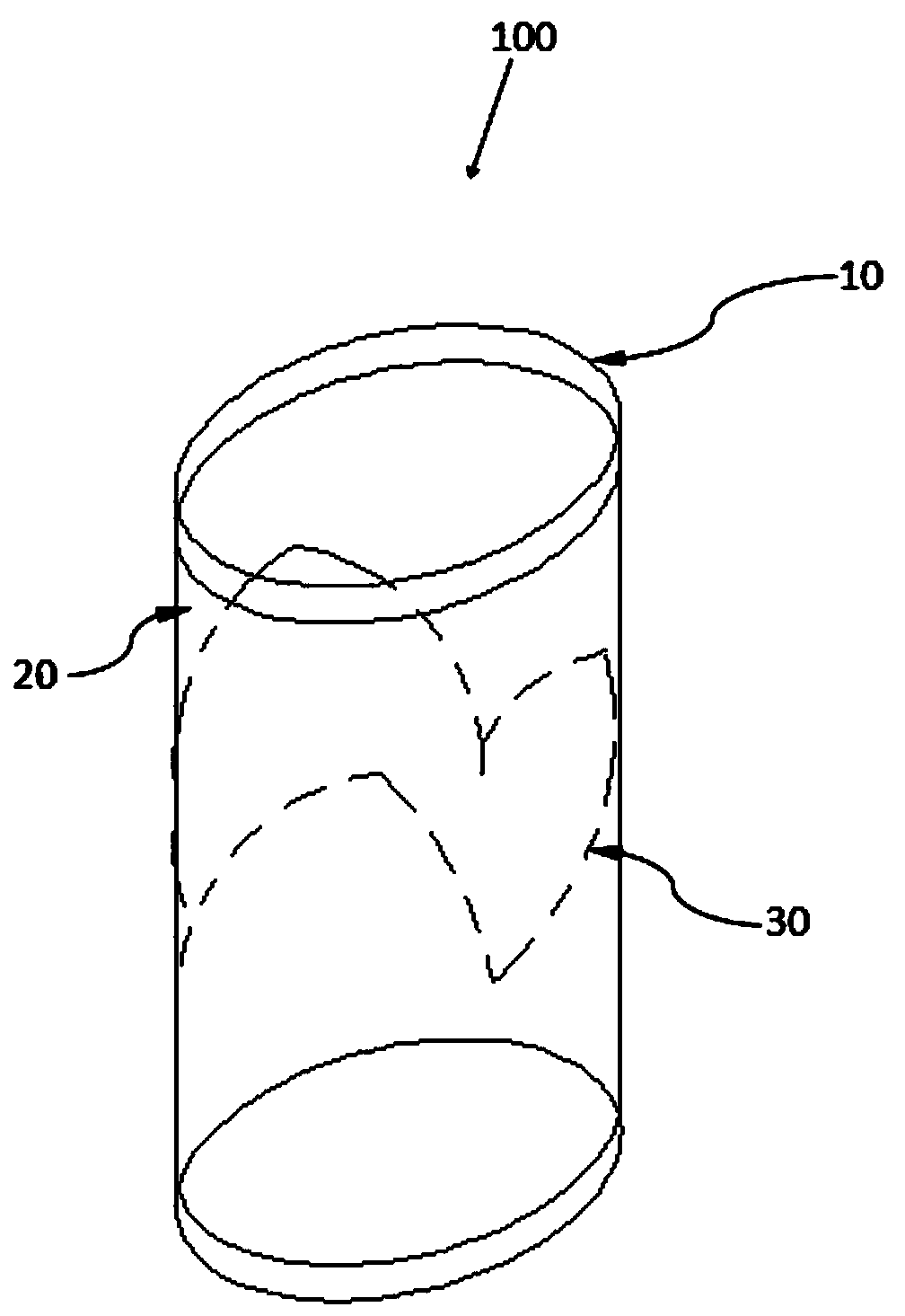 Durable enhanced implant having three-leaf bioprosthetic valve and preparation method of durable enhanced implant having three-leaf bioprosthetic valve