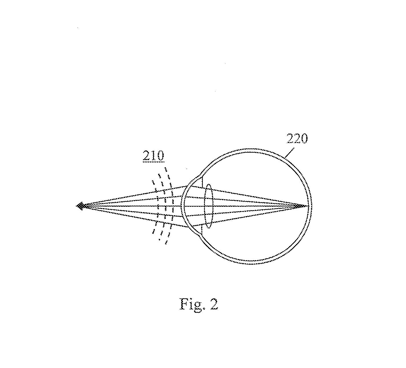 Electronic eye marking/registration