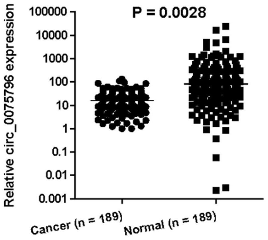 Application of circular RNA (Ribonucleic Acid) in preparation of breast cancer diagnosis product