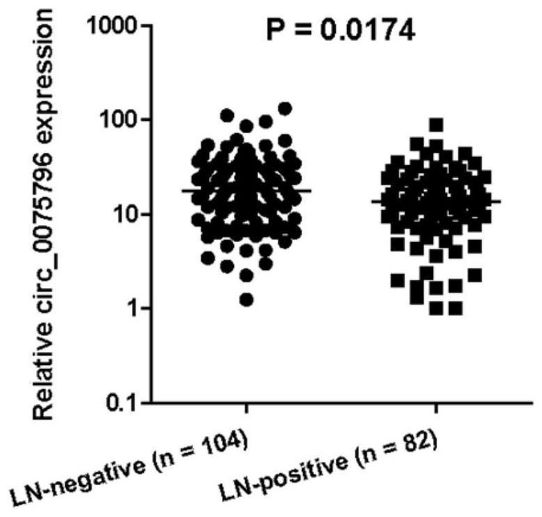 Application of circular RNA (Ribonucleic Acid) in preparation of breast cancer diagnosis product