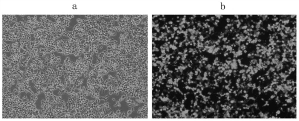 A kind of anti-tumor NK cell and its preparation method and application