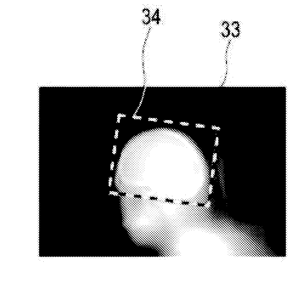 Scan region determining apparatus