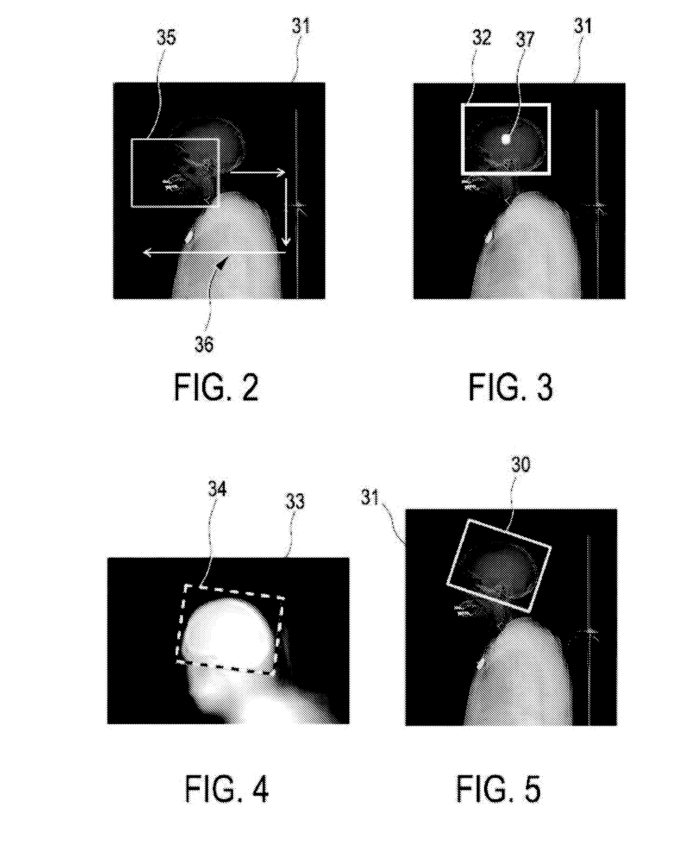 Scan region determining apparatus