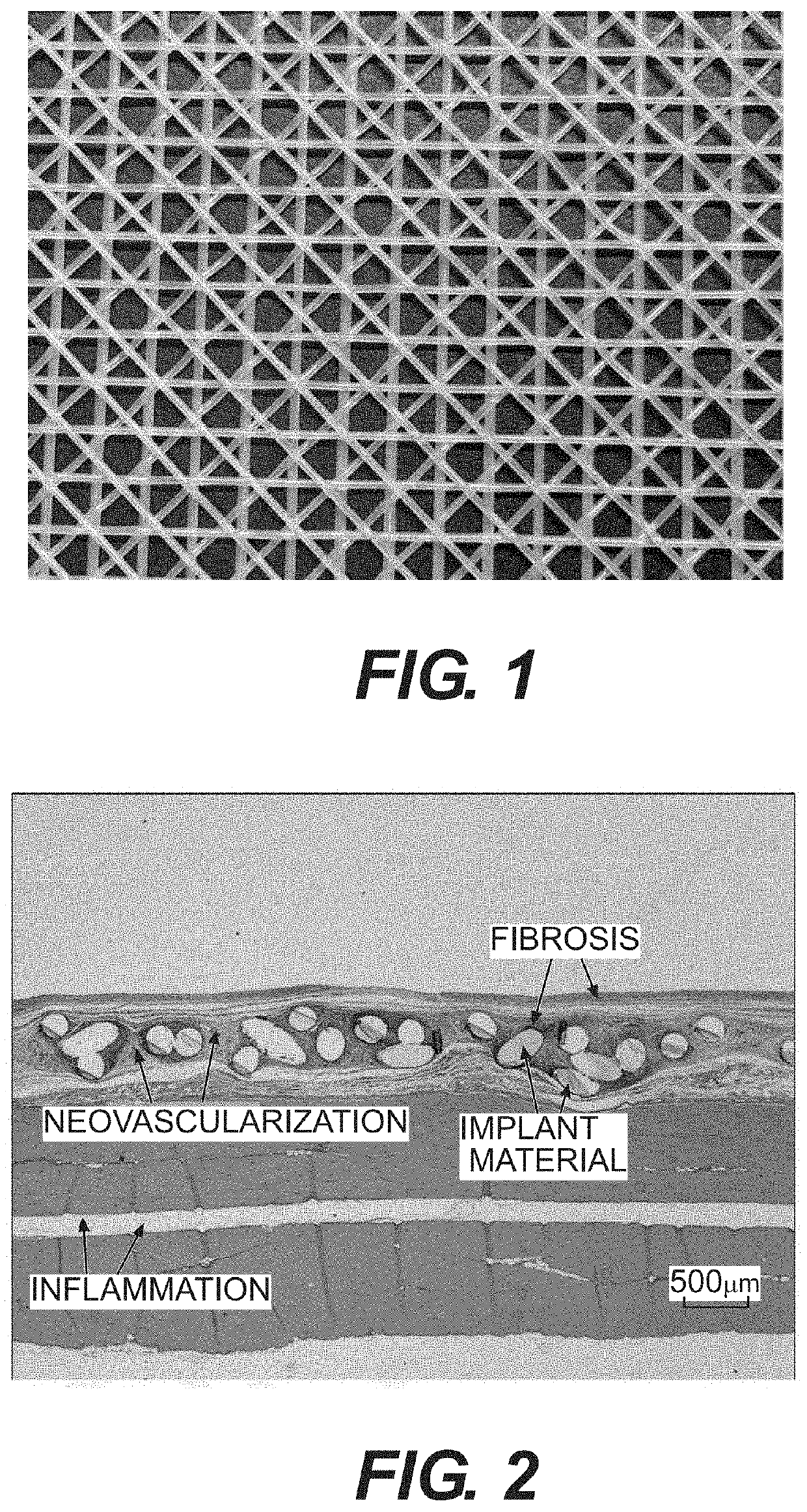 Medical devices containing compositions of poly(butylene succinate) and copolymers thereof