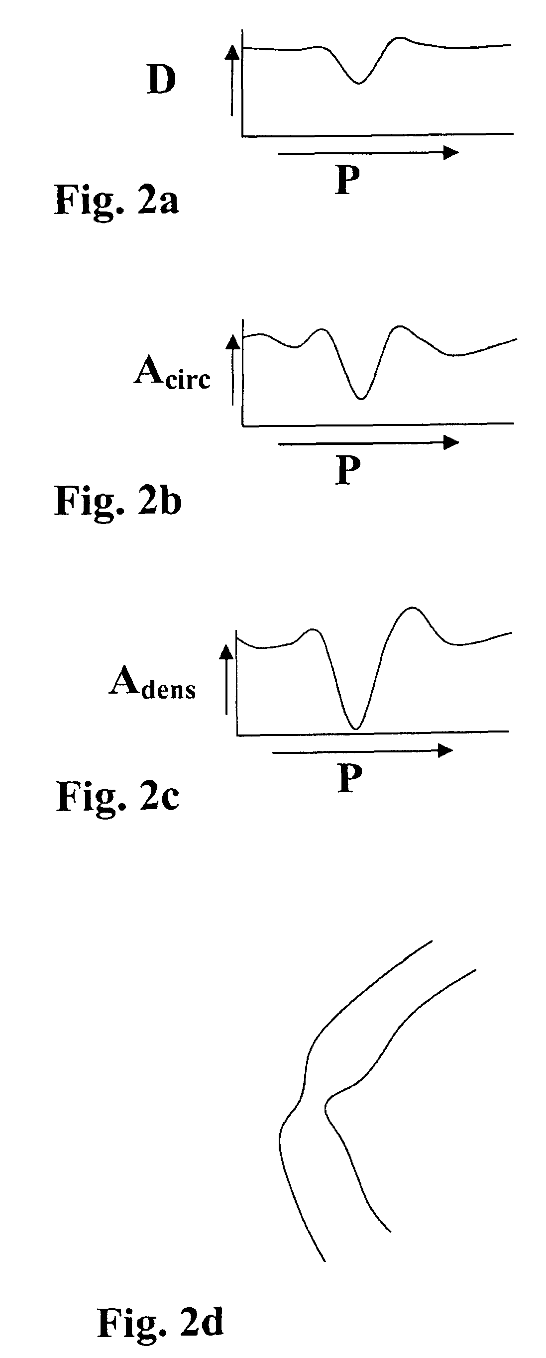 Method, apparatus and computer program for contour detection of vessels using x-ray densitometry