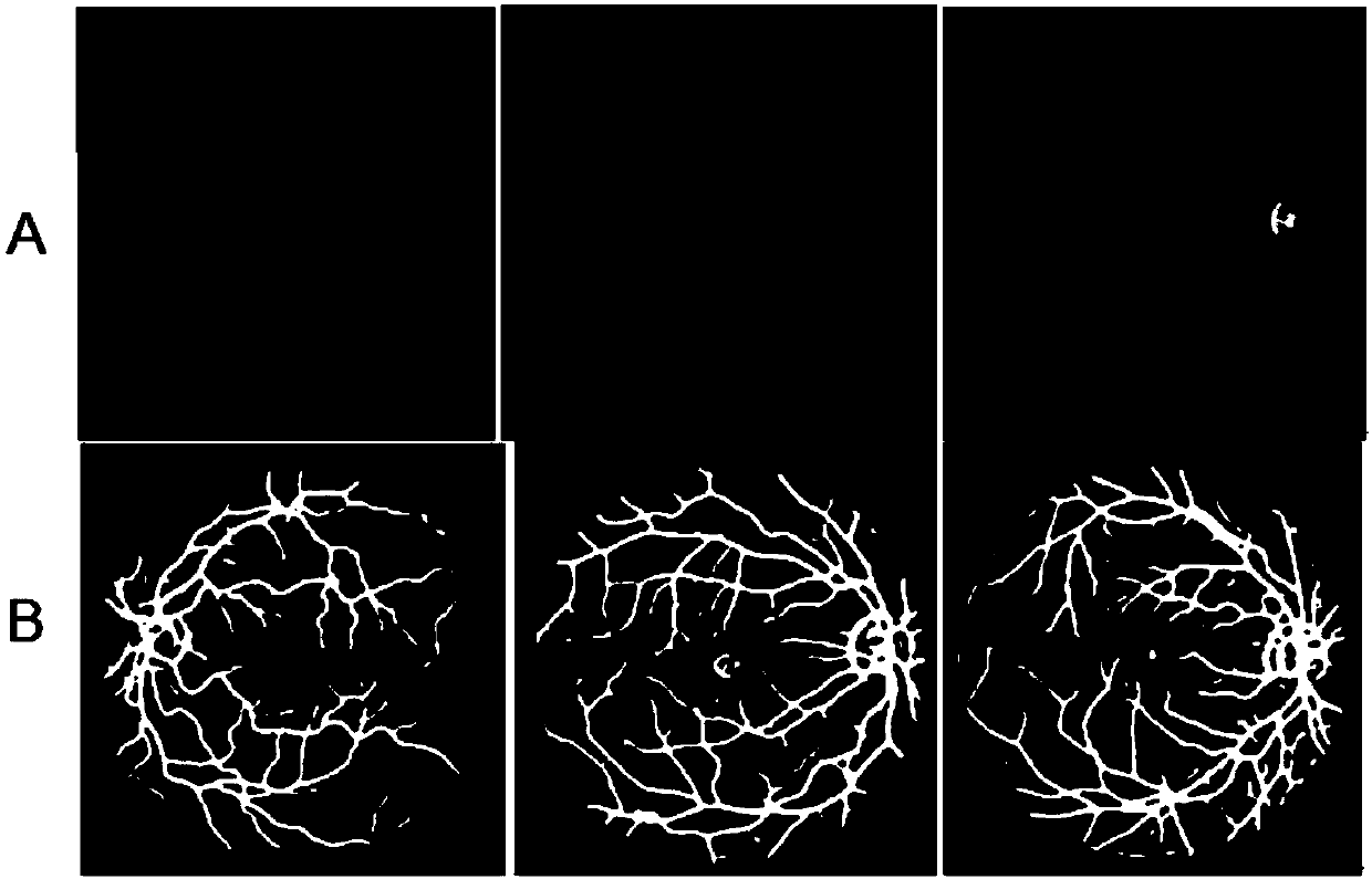 Retinal vessel three-dimensional reconstruction method based on portable digital fundus camera