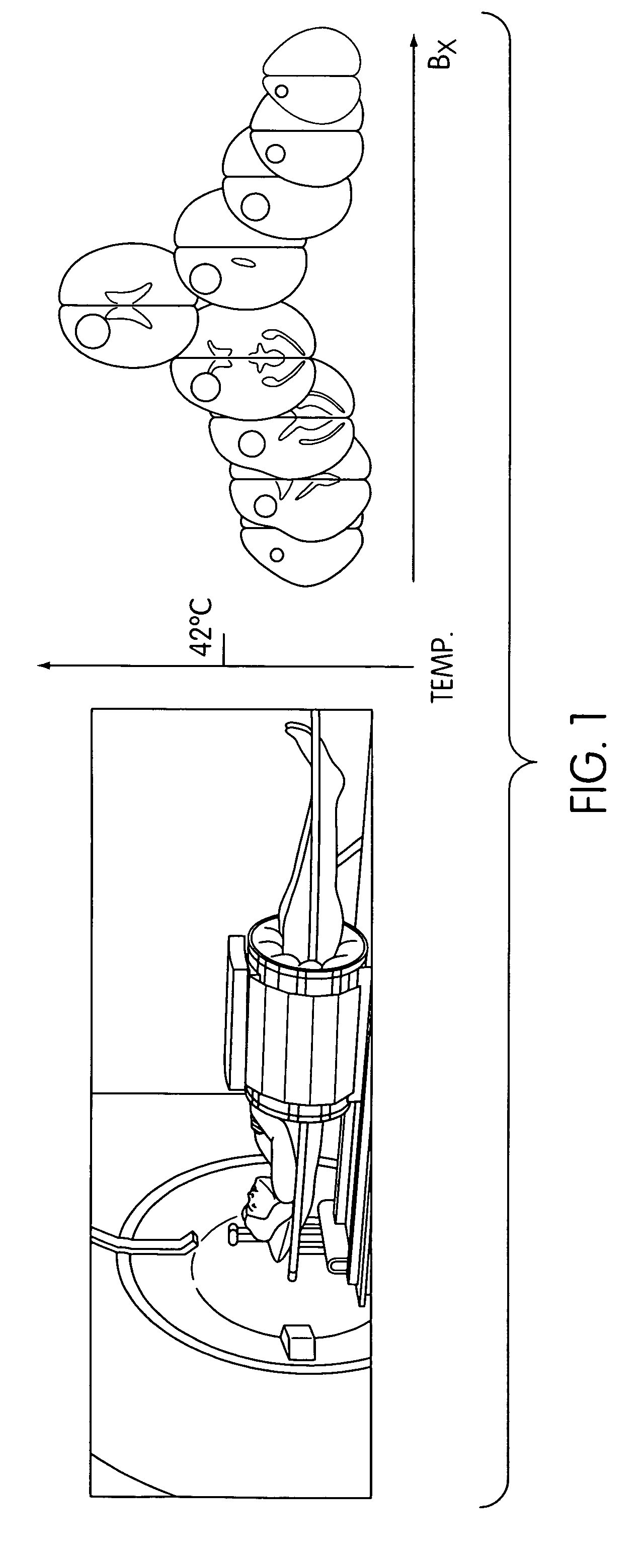 Remotely RF powered conformable thermal applicators