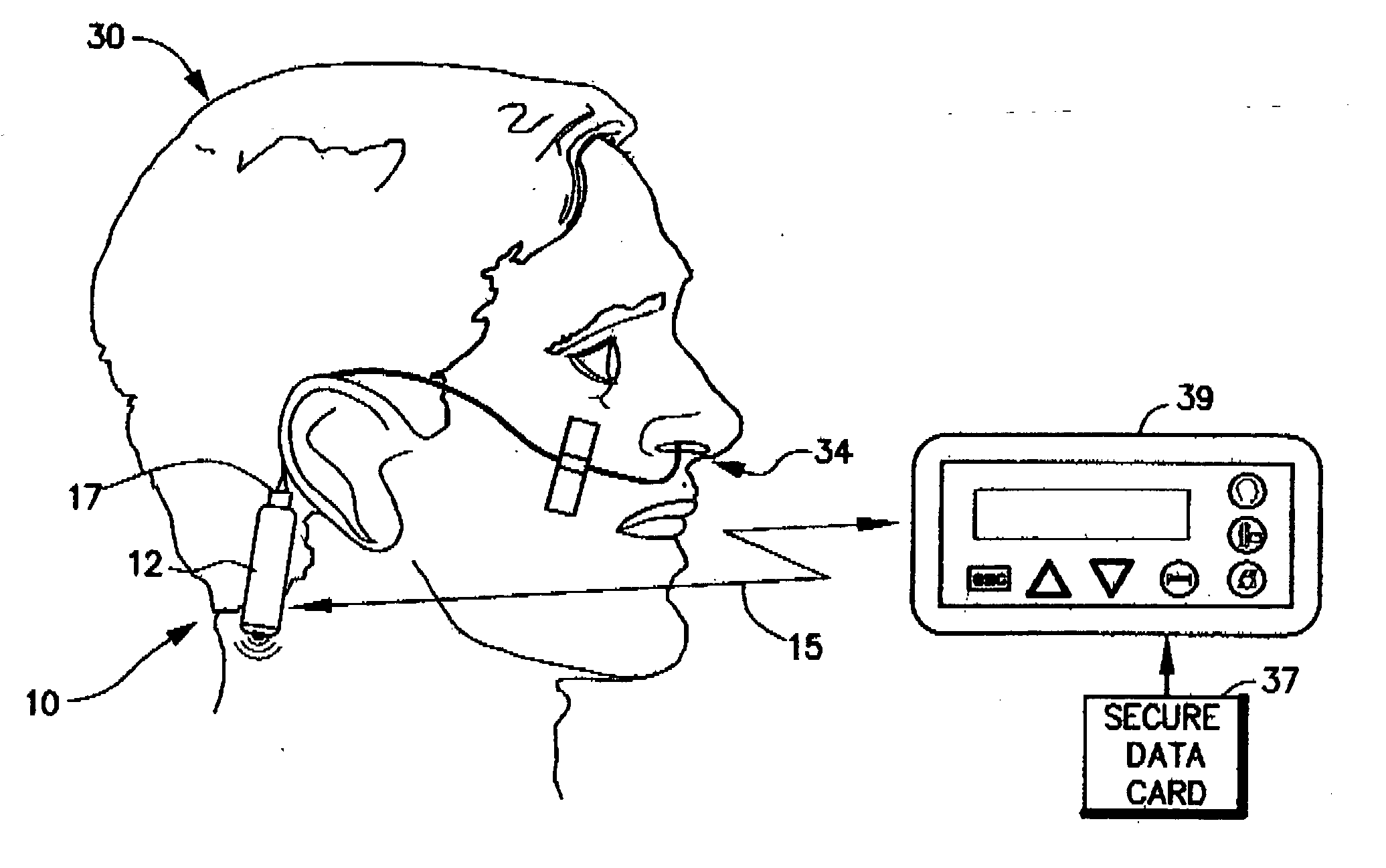 Self-condensing pH sensor and catheter apparatus