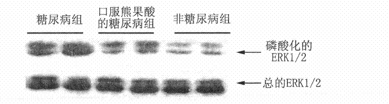 Application of low-dose ursolic acid as medicament for treating diabetic early nephropathy