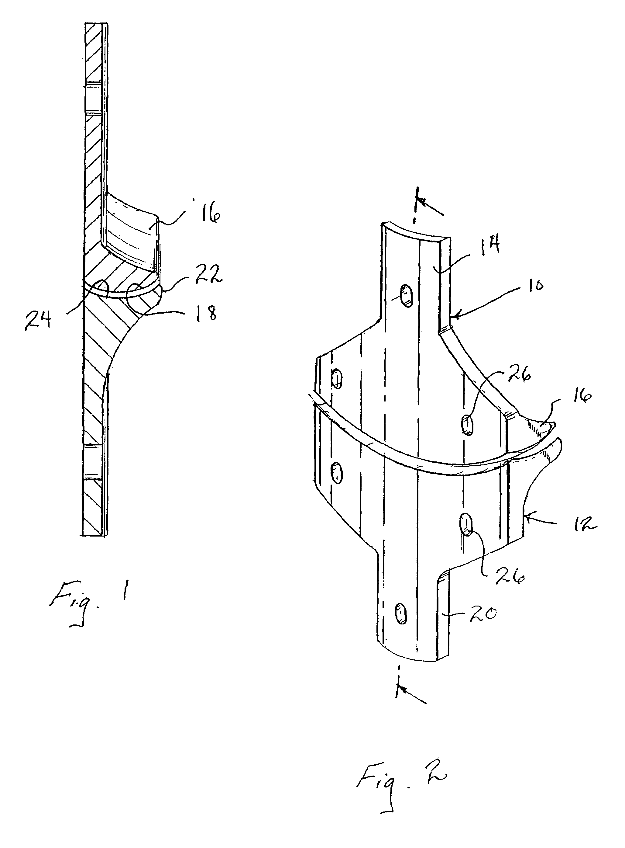 Internal brace for distraction arthroplasty