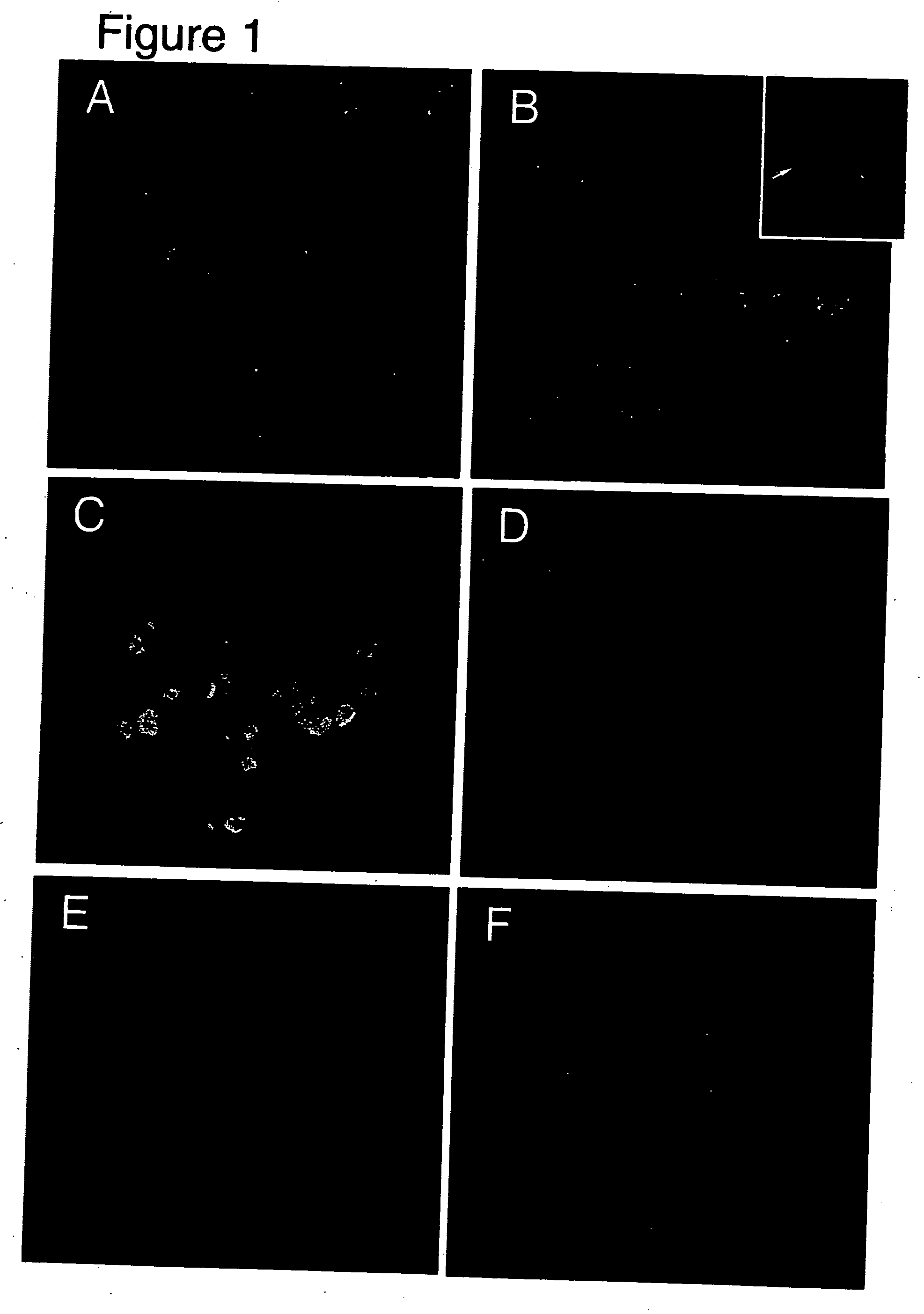 Methods and compositions for the treatment of neurological diseases and disorders