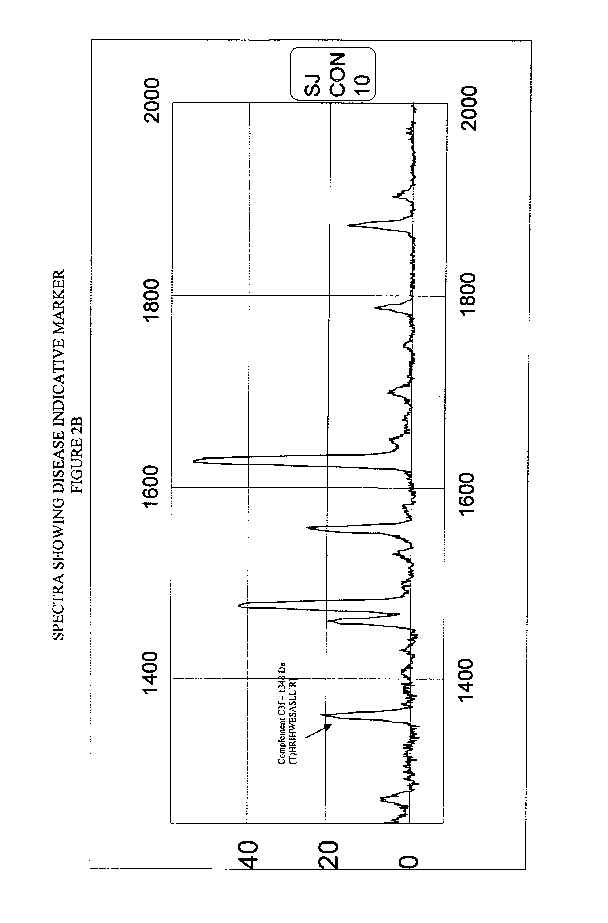 Biopolymer marker indicative of disease state having a molecular weight of 1348 daltons