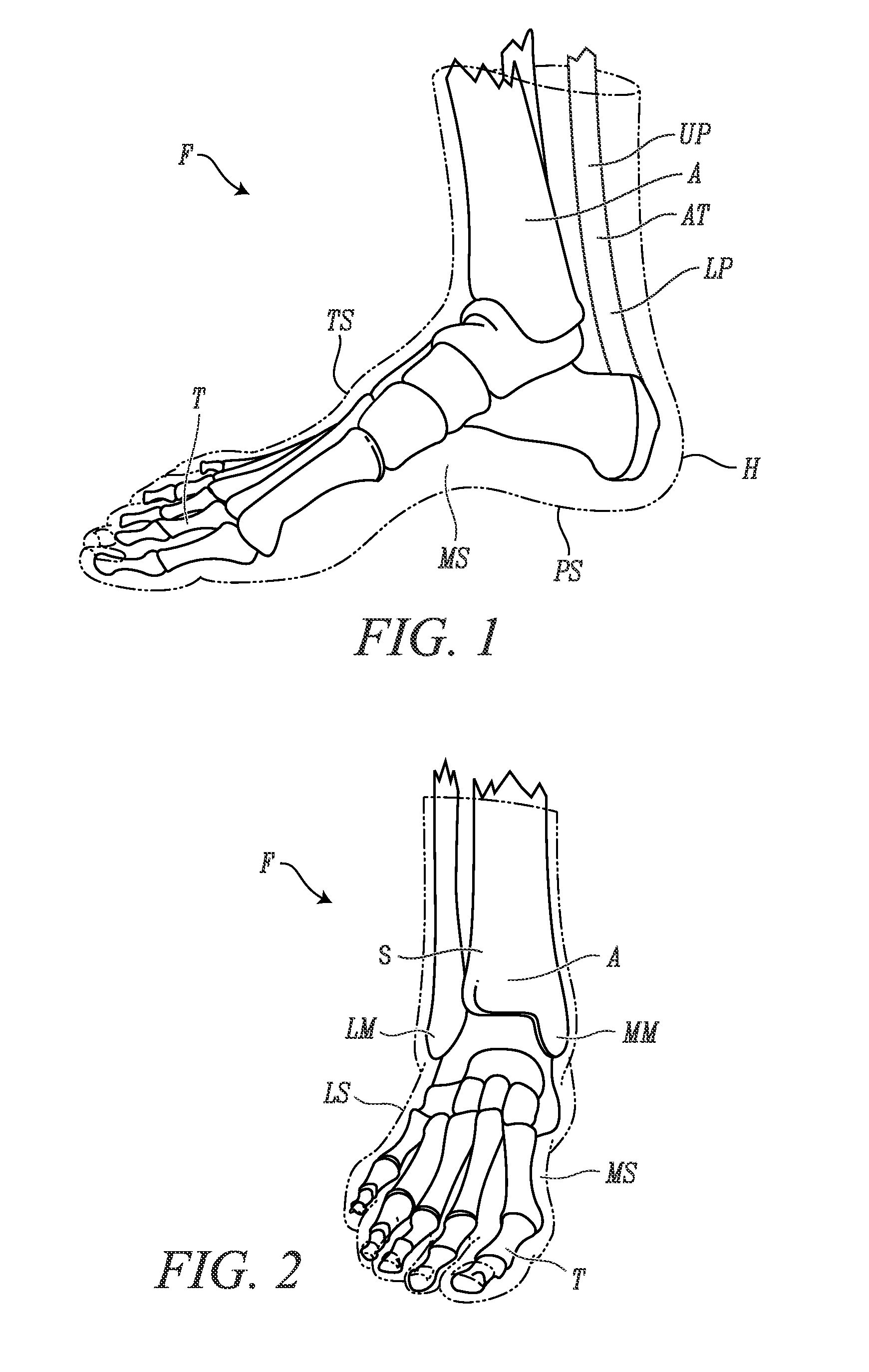 Skate boot having a toe cap with rear extensions