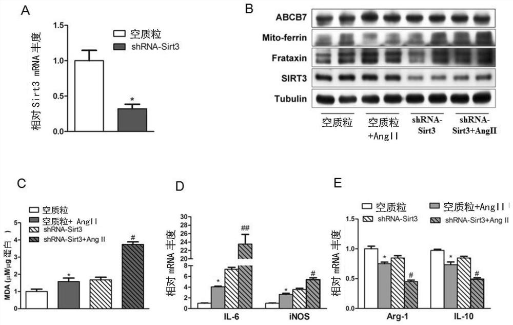 Application of SIRT3 mediated macrophage Fraxin deacetylation modification in improvement of inflammatory diseases