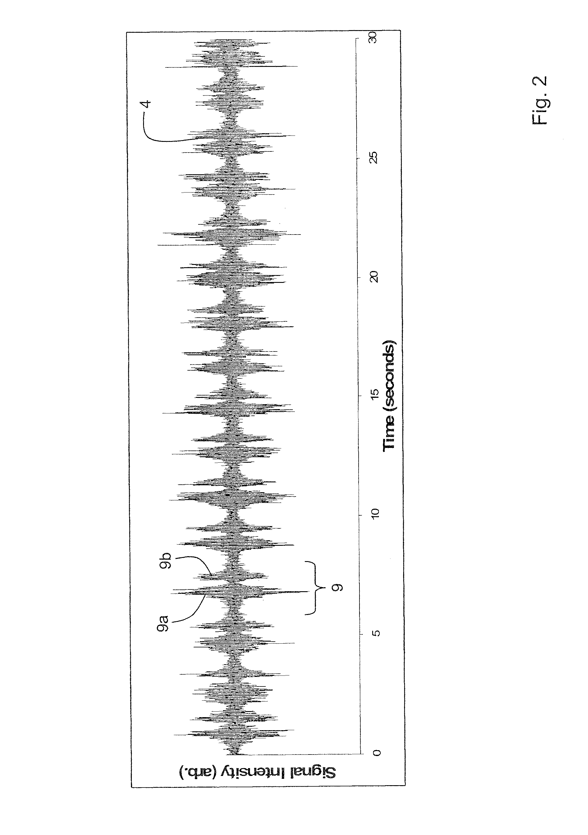 Device for determining respiratory rate and other vital signs