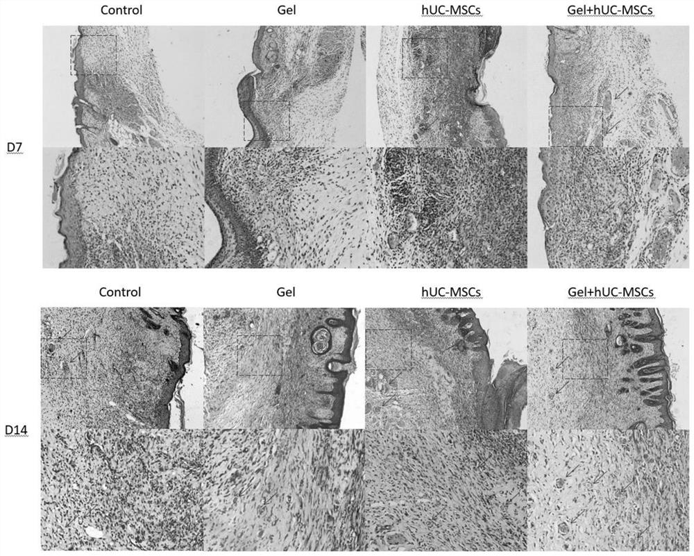 Fibrin hydrogel stent loaded with human umbilical cord mesenchymal stem cells and application of fibrin hydrogel stent