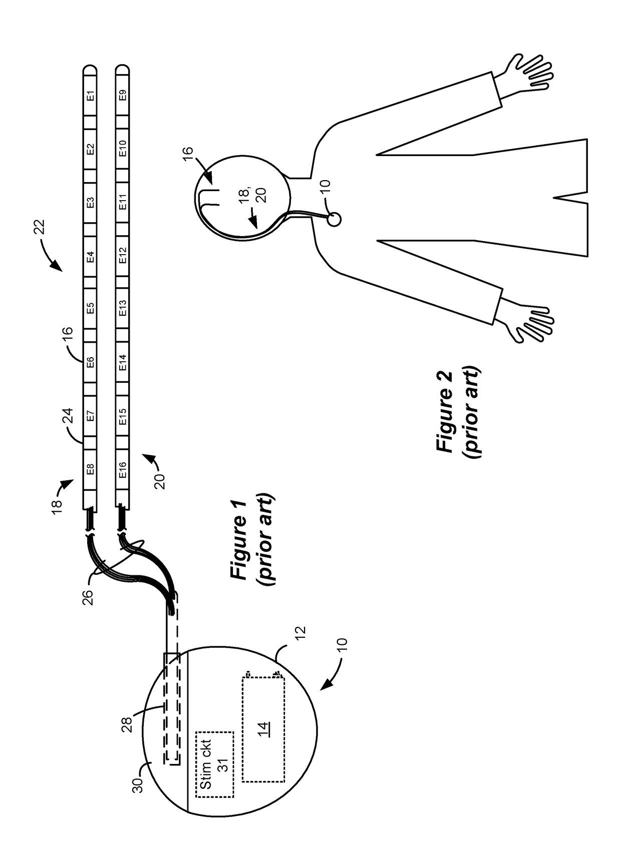 Enhanced Selectivity and Modulation in Coordinated Reset in Deep Brain Stimulation