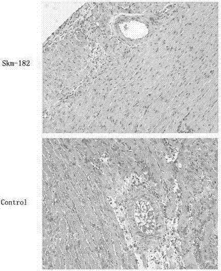 A miRNA-182 inhibitor and its application in the preparation of drugs for preventing and treating immune rejection in heart transplantation