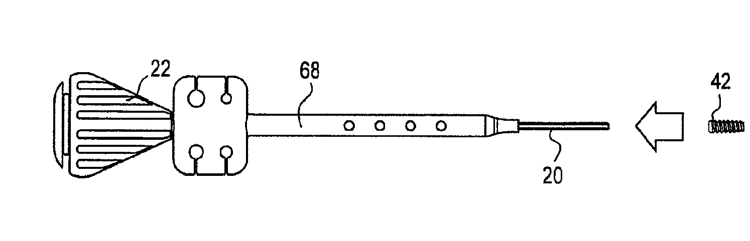 Fenestrated swivel anchor for knotless fixation of tissue