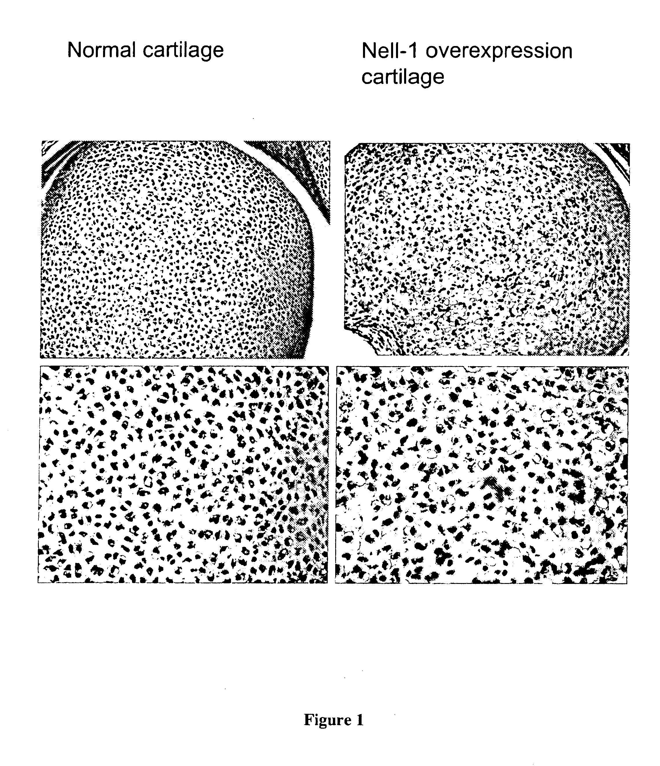 Composition for Promoting Cartilage Formation or Repair Comprising a NELL Gene Product and Method of Treating Cartilage-Related Conditions Using Such Composition