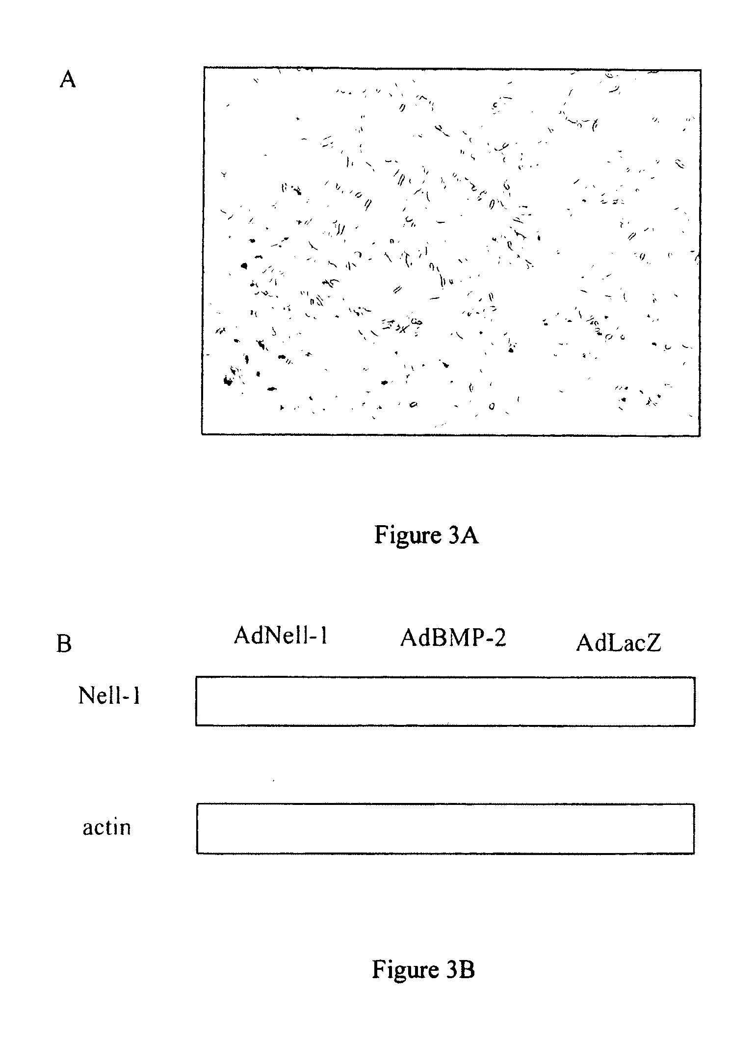 Composition for Promoting Cartilage Formation or Repair Comprising a NELL Gene Product and Method of Treating Cartilage-Related Conditions Using Such Composition