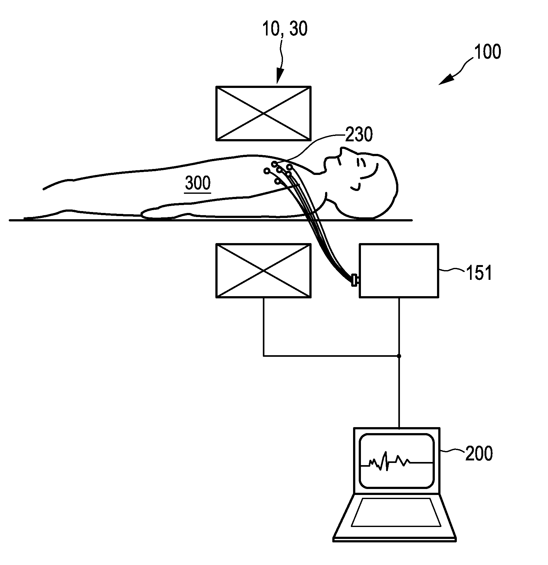 Apparatus and method for non-invasive intracardiac electrocardiography using mpi