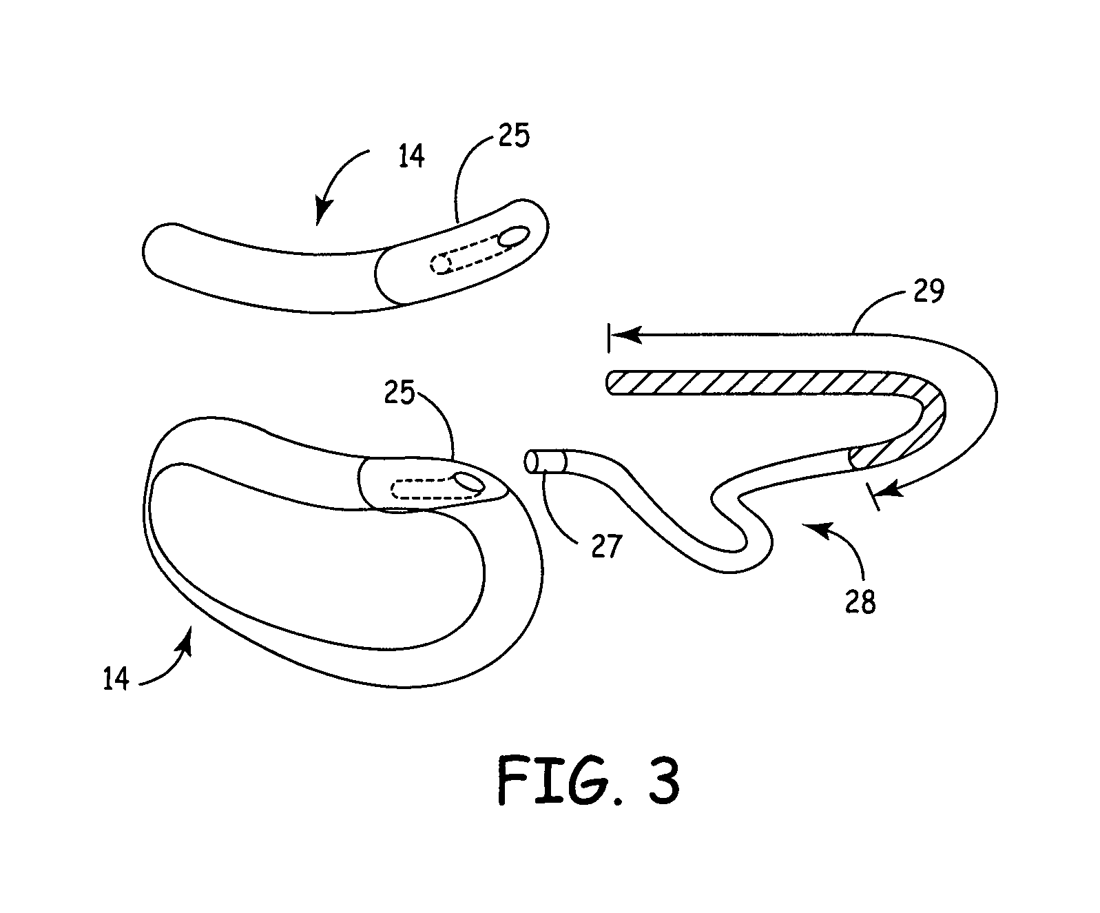 Remotely enabled pacemaker and implantable subcutaneous cardioverter/defibrillator system