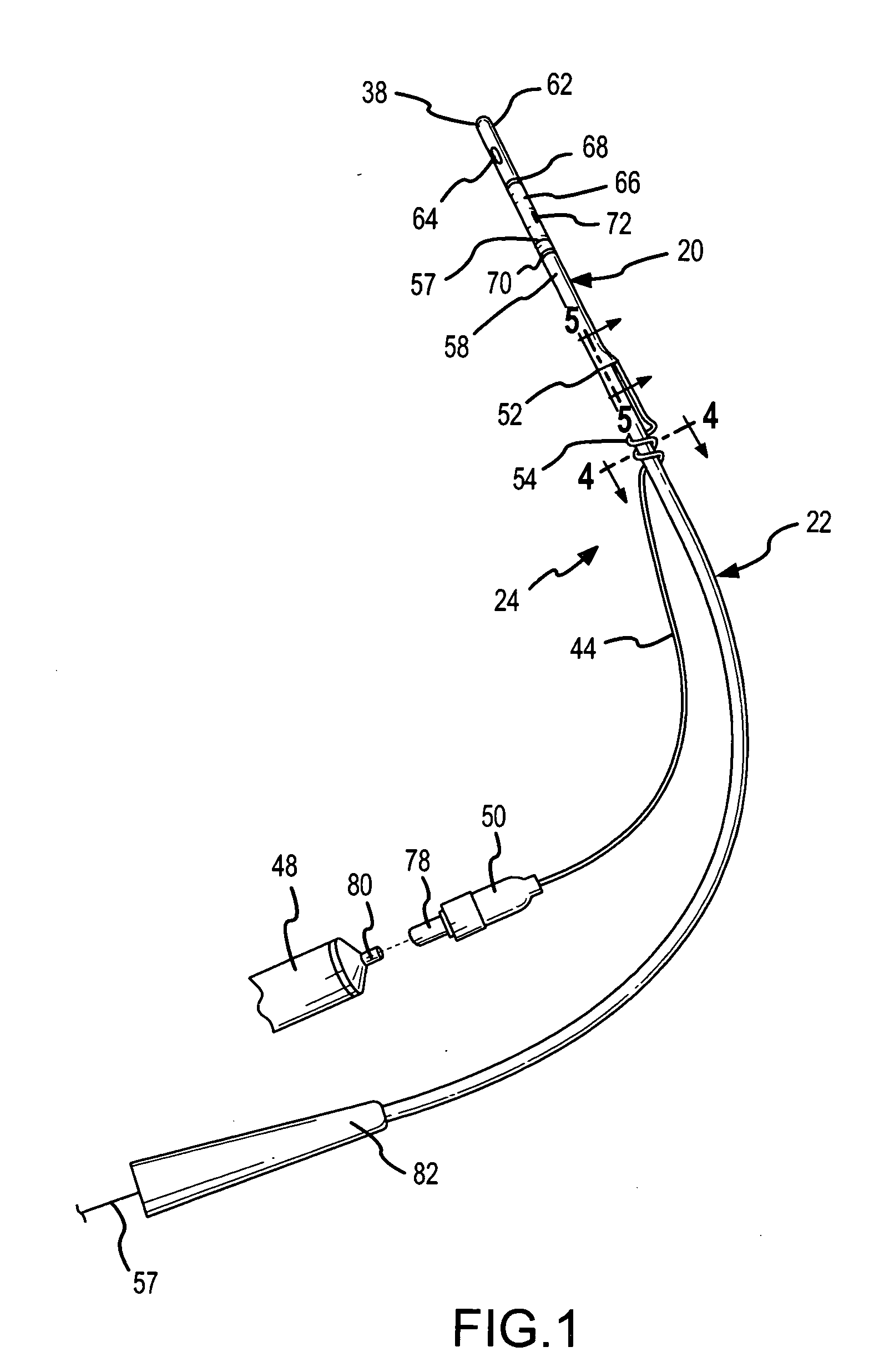 Partial-length indwelling urinary catheter and method permitting selective urine discharge