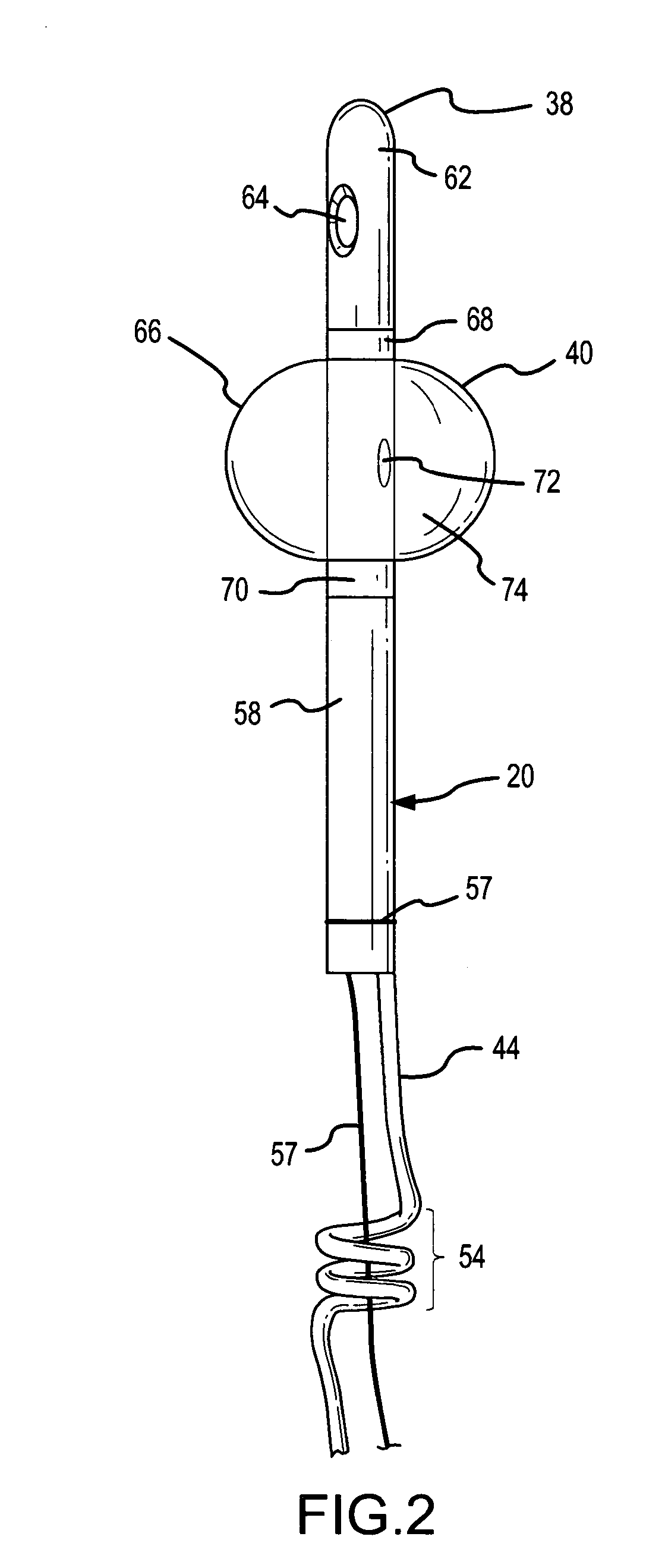 Partial-length indwelling urinary catheter and method permitting selective urine discharge