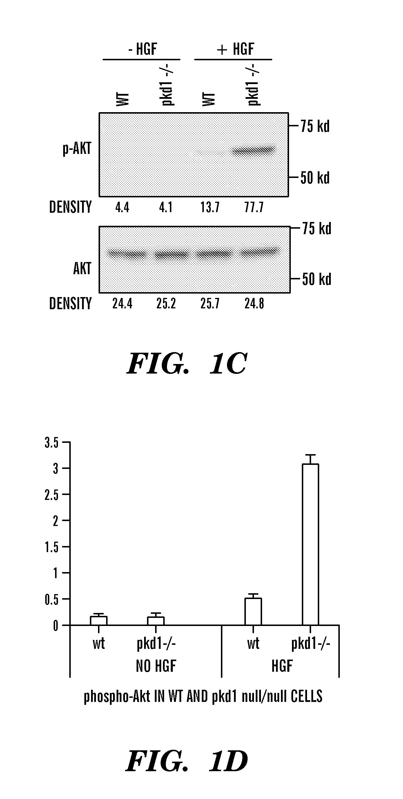 Method of treating polycystic kidney disease