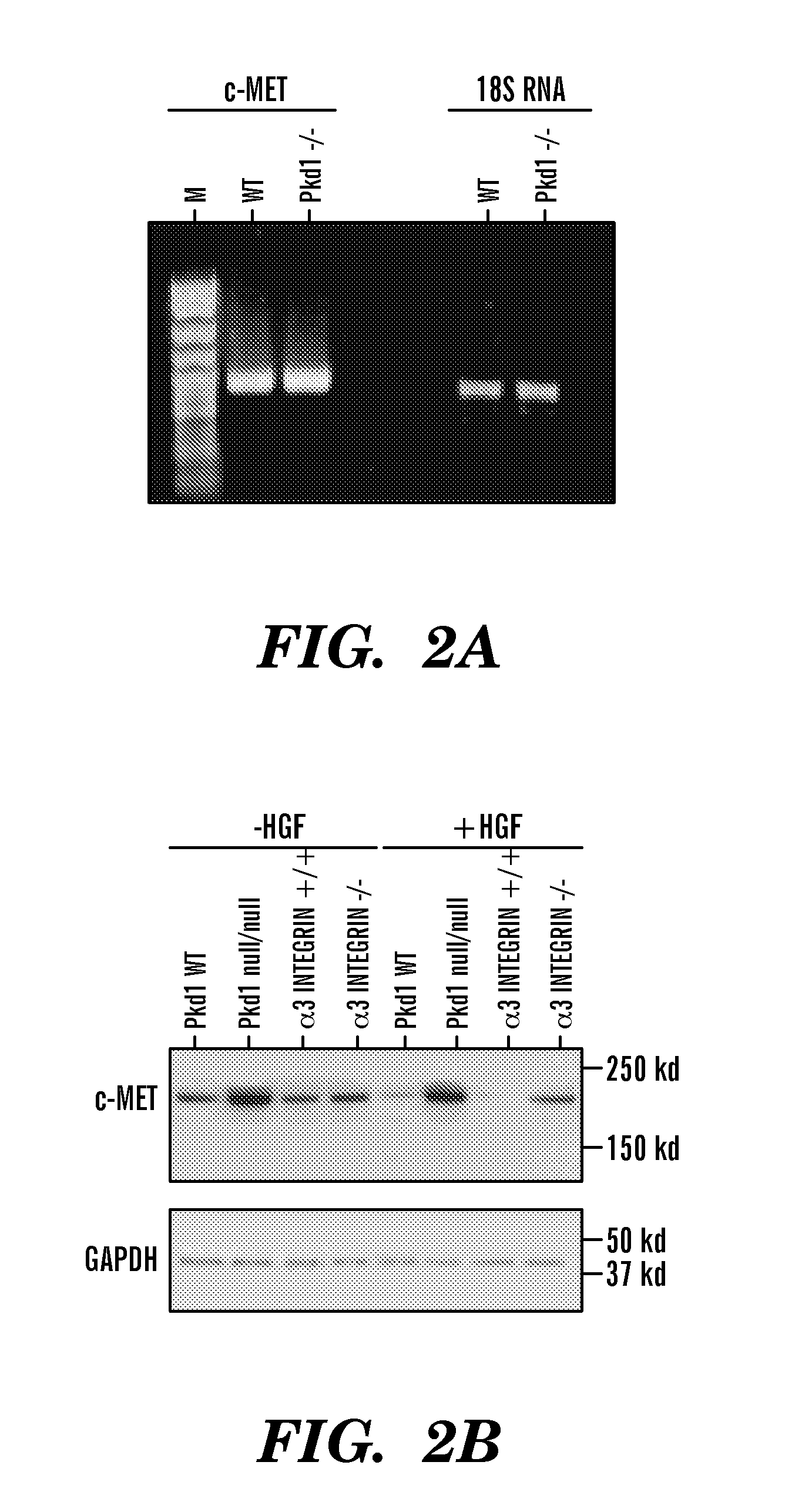 Method of treating polycystic kidney disease