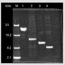 Preparation of troponin I specific locus antibody and detection kit thereof