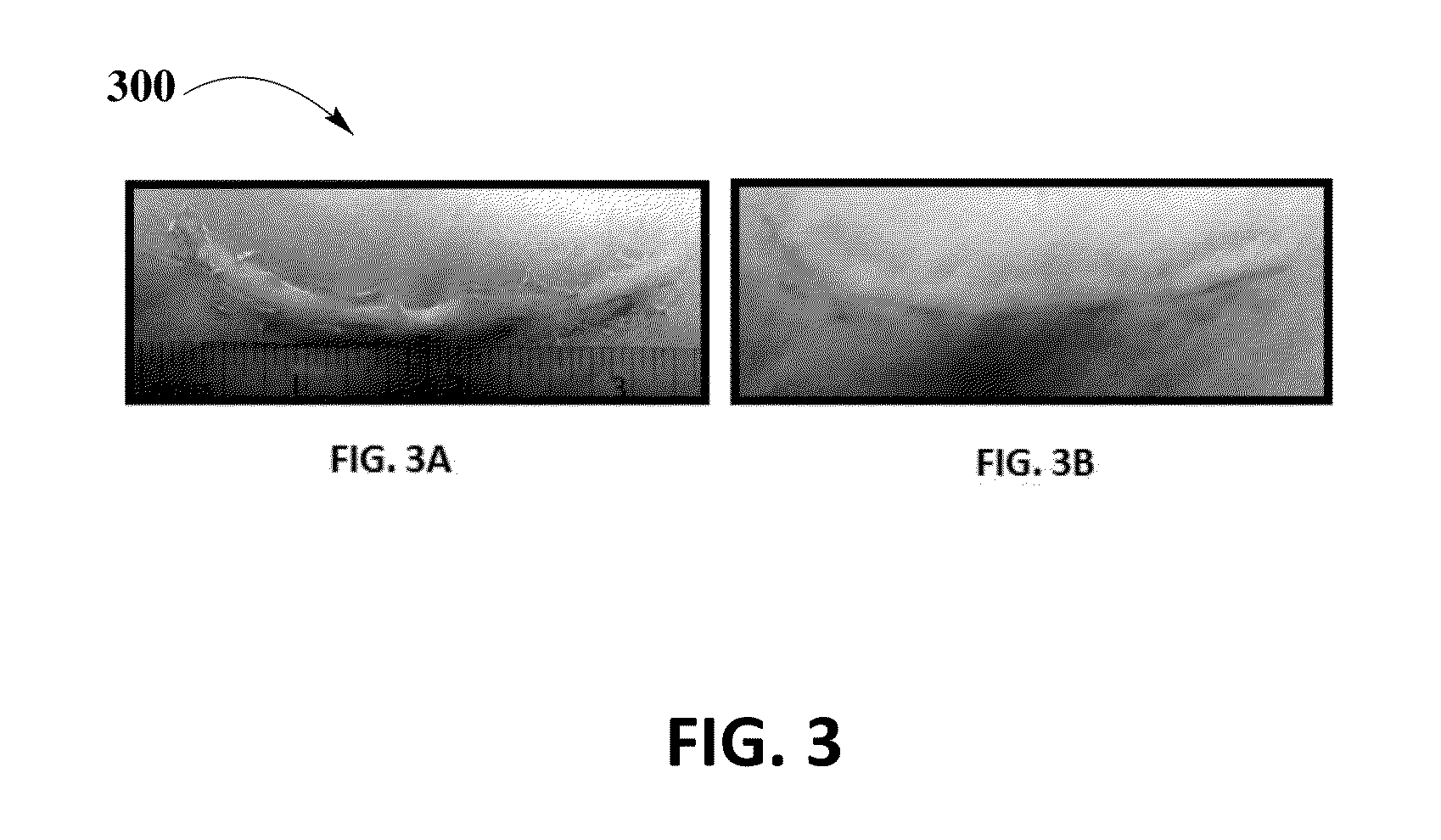 Mixture of Betamethasone and Tranilast with a Transdermal Gel for Scar Treatment