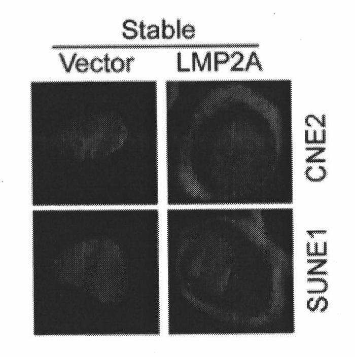 Preparation method and applications of anti-latent membrane protein LMP2A monoclonal antibody