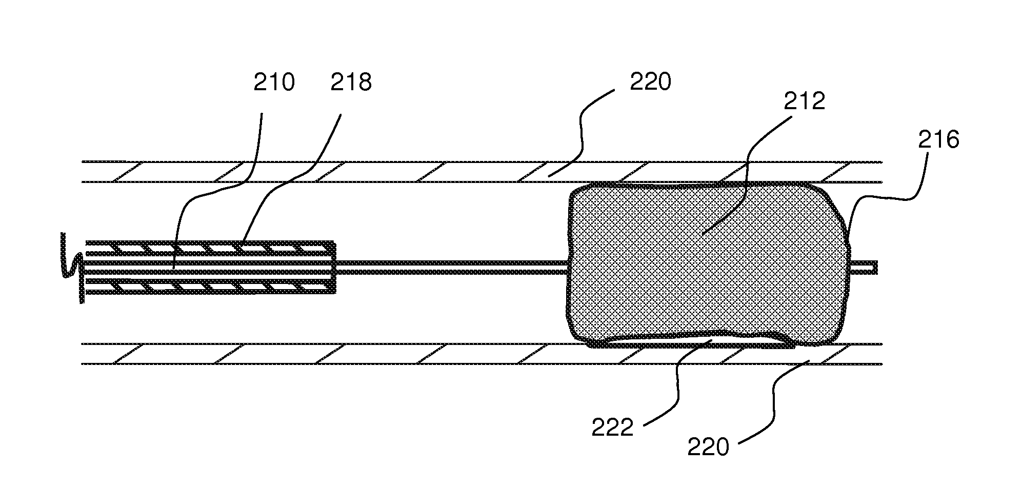 Local delivery of water-soluble or water-insoluble therapeutic agents to the surface of body lumens