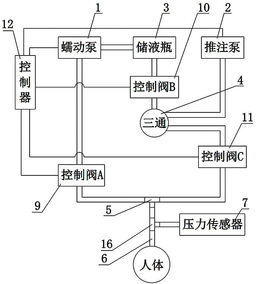 Automatic filling device used for urodynamic detection