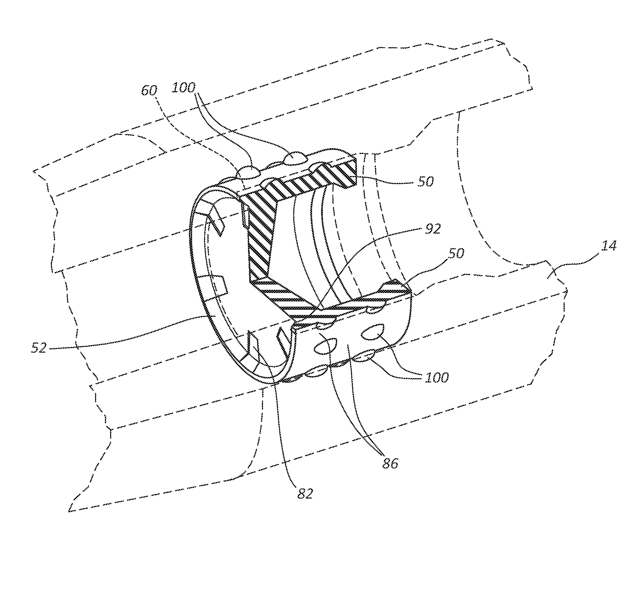 Systems and methods for sealing a septum within a catheter device