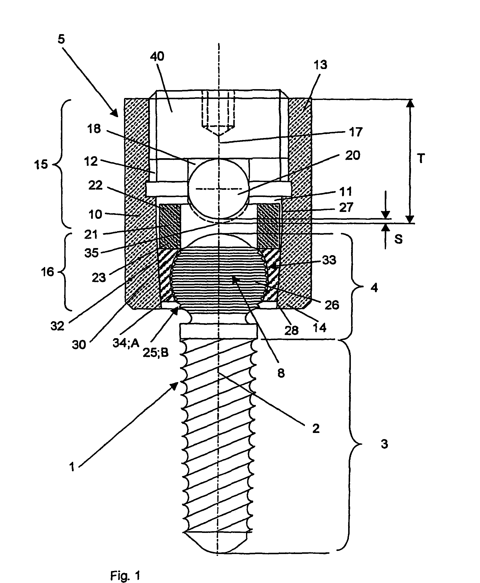 Device for the dynamic fixation of bones