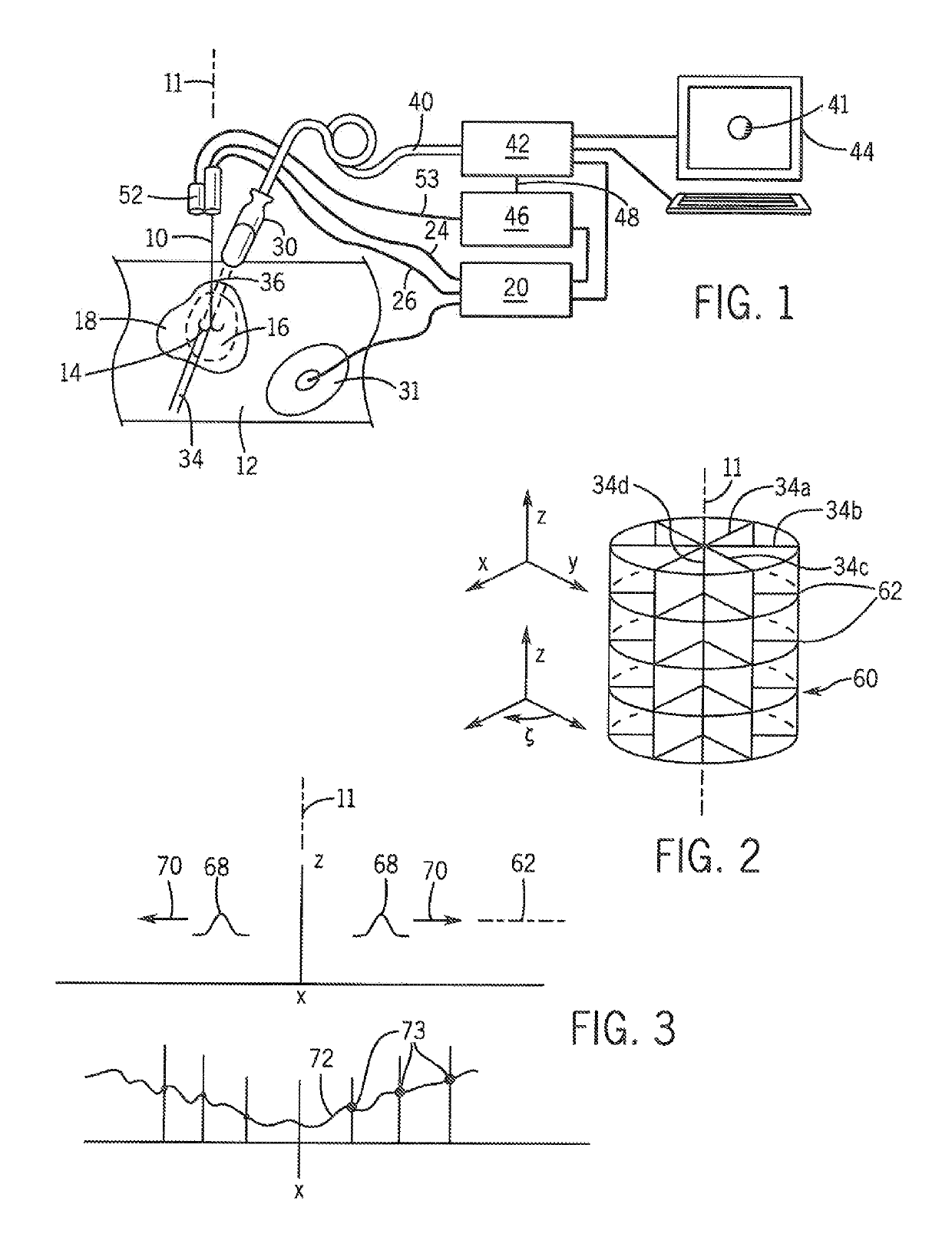 Method and apparatus for rapid acquisition of elasticity data in three dimensions