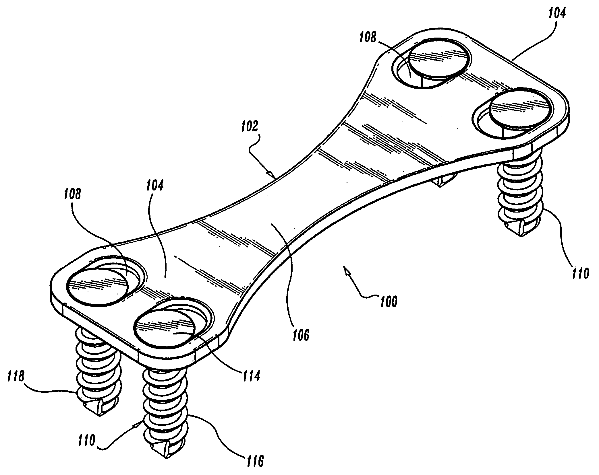 Method of repairing a bone joint