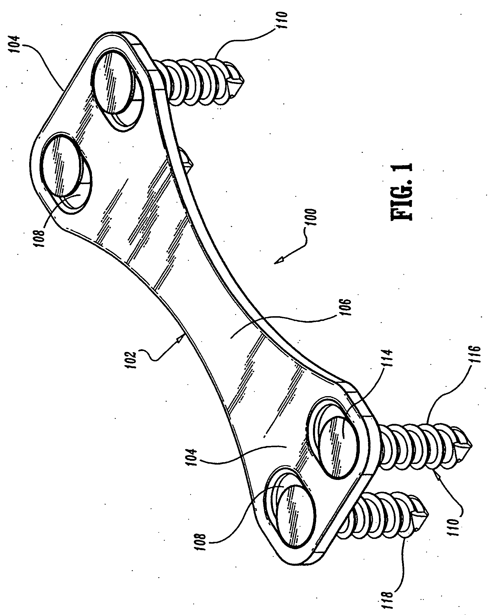 Method of repairing a bone joint