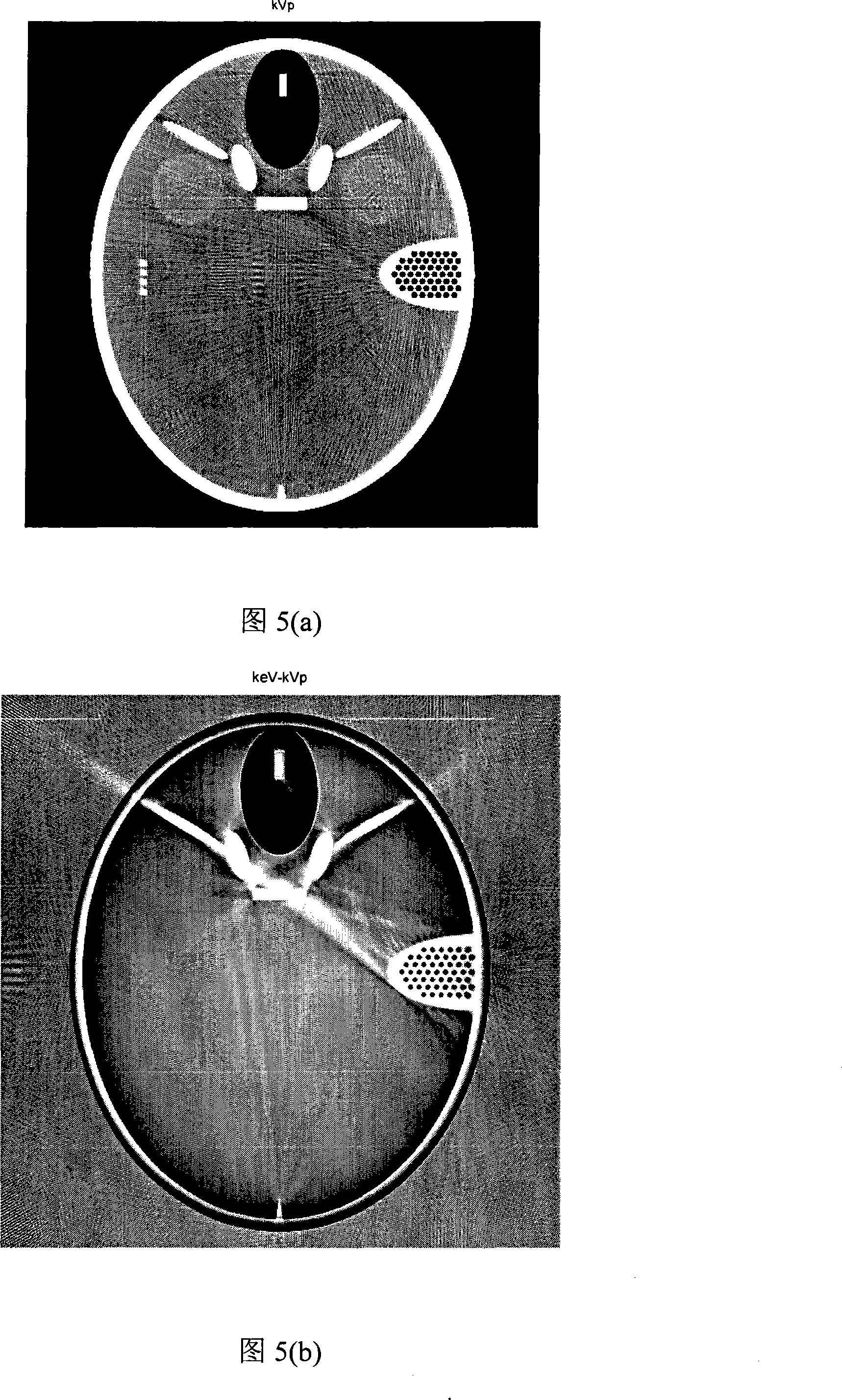 Method for correcting projection pencil sclerosis based on CT data consistency