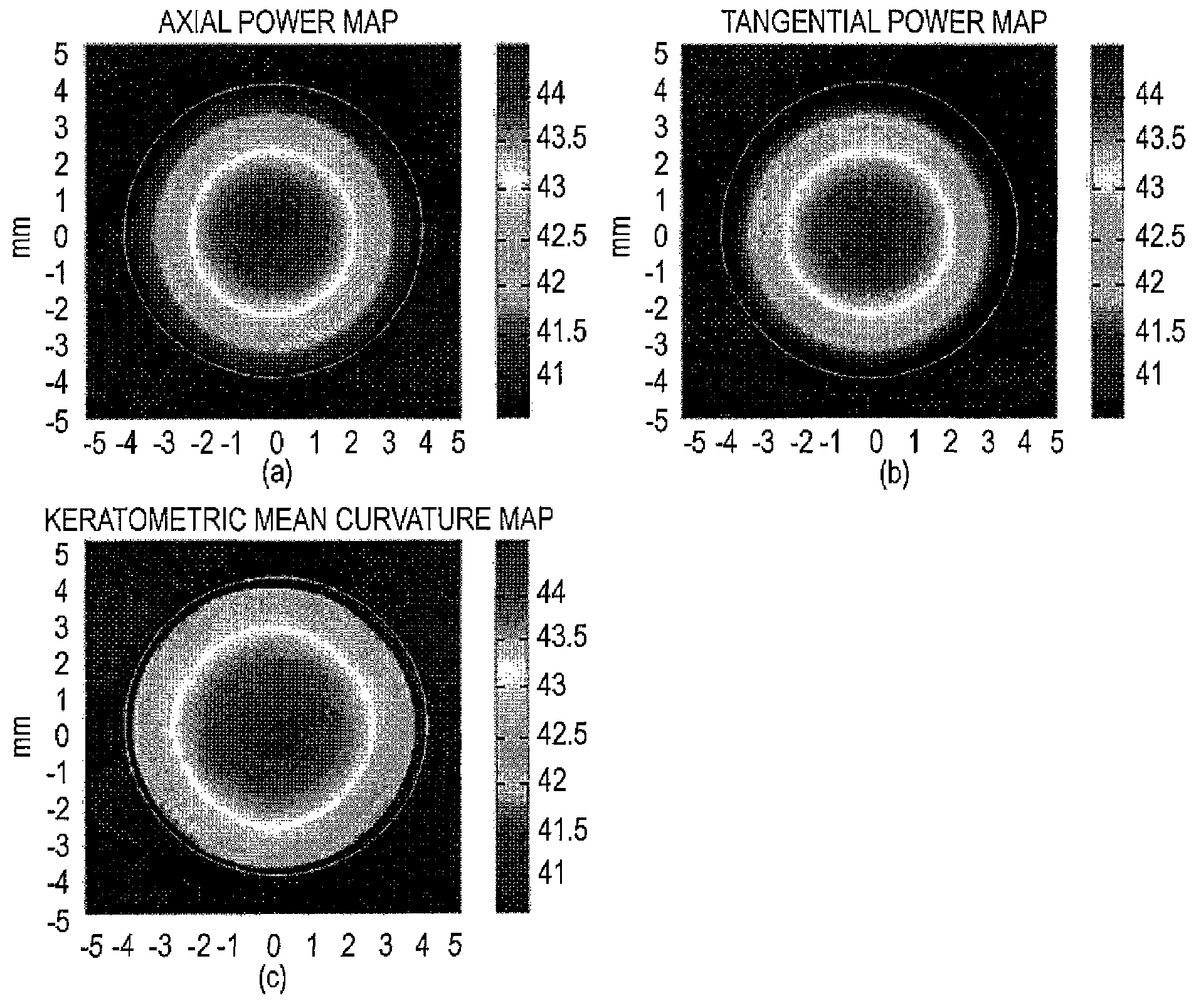 Gaussian fitting on mean curvature maps of parameterization of corneal ectatic diseases