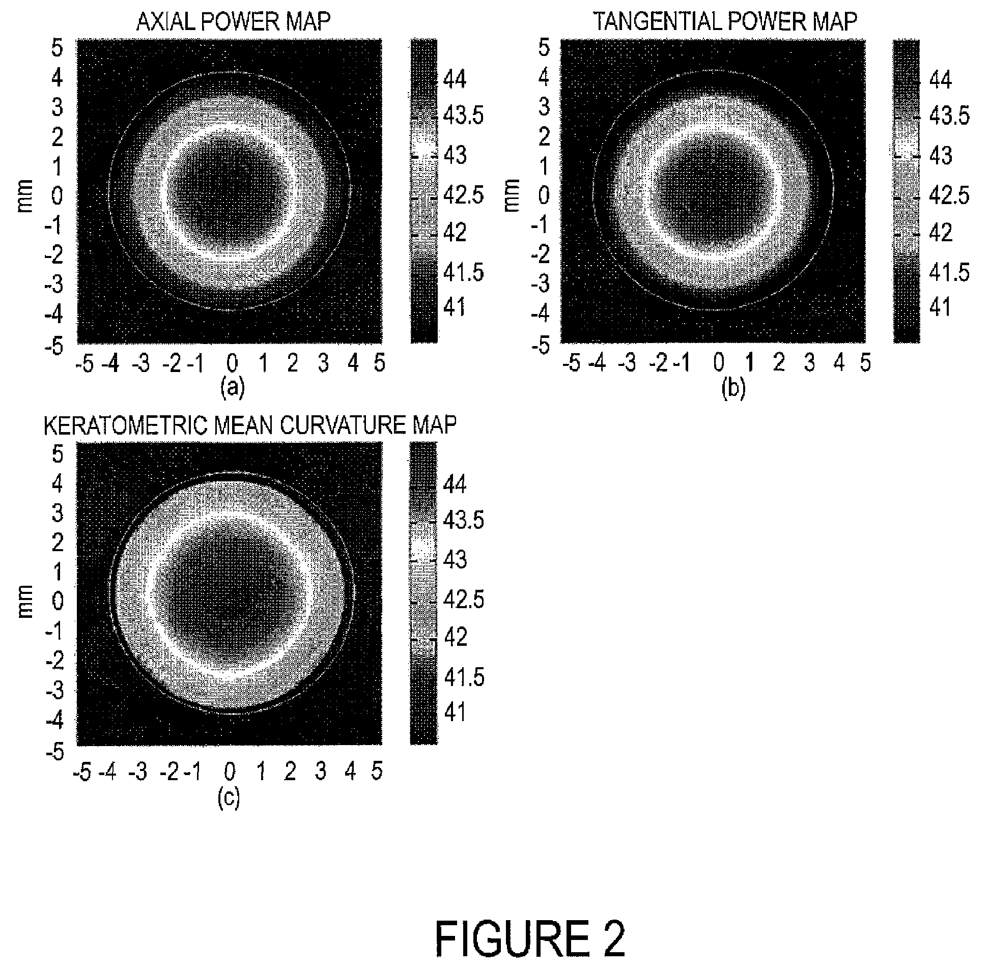 Gaussian fitting on mean curvature maps of parameterization of corneal ectatic diseases