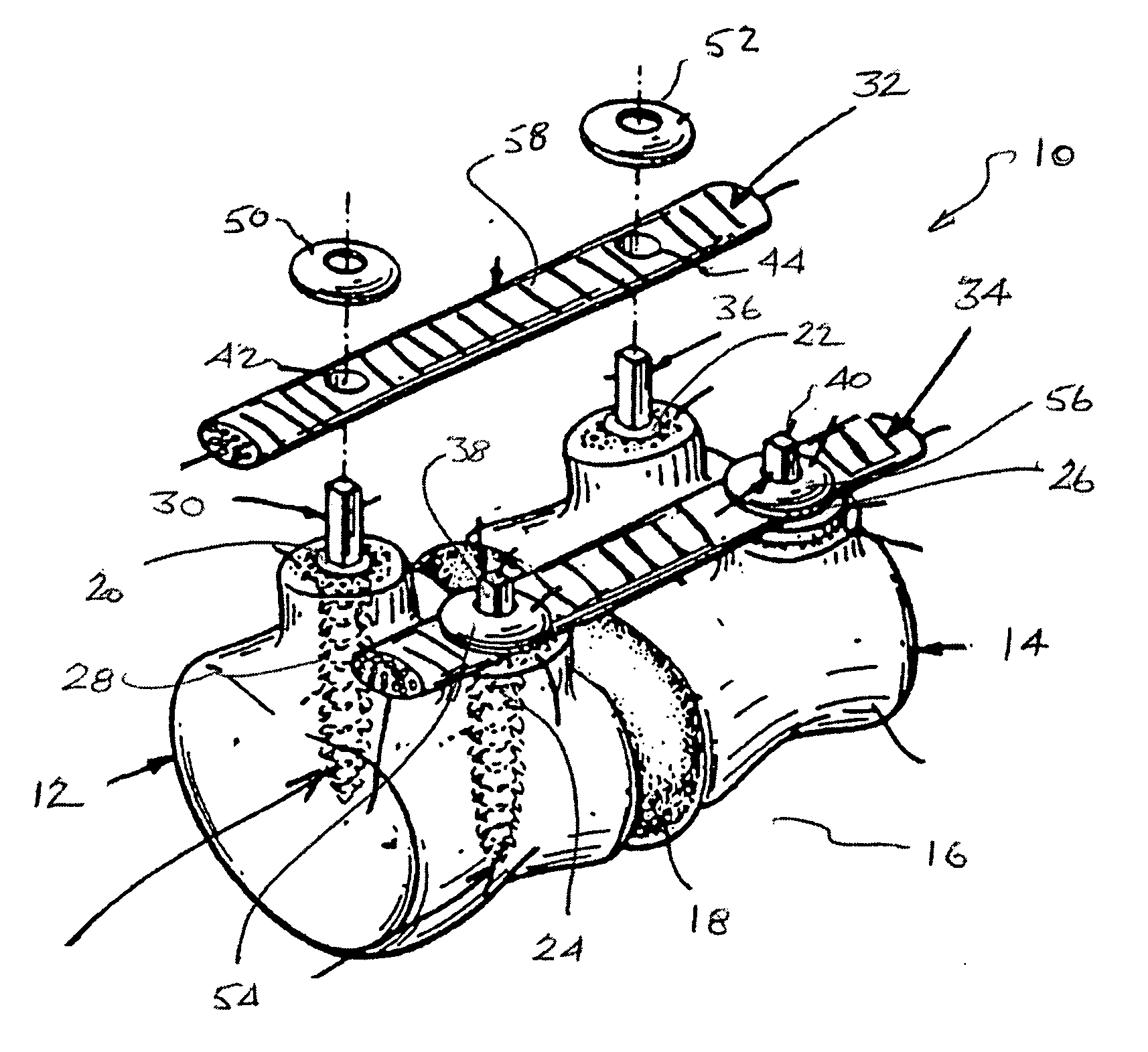 Dynamic spinal stabilization system