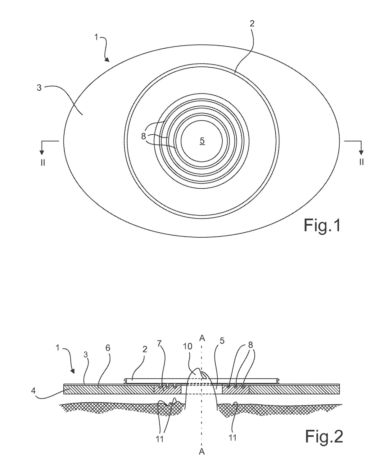 Ostomy base plate with mouldable inner adhesive