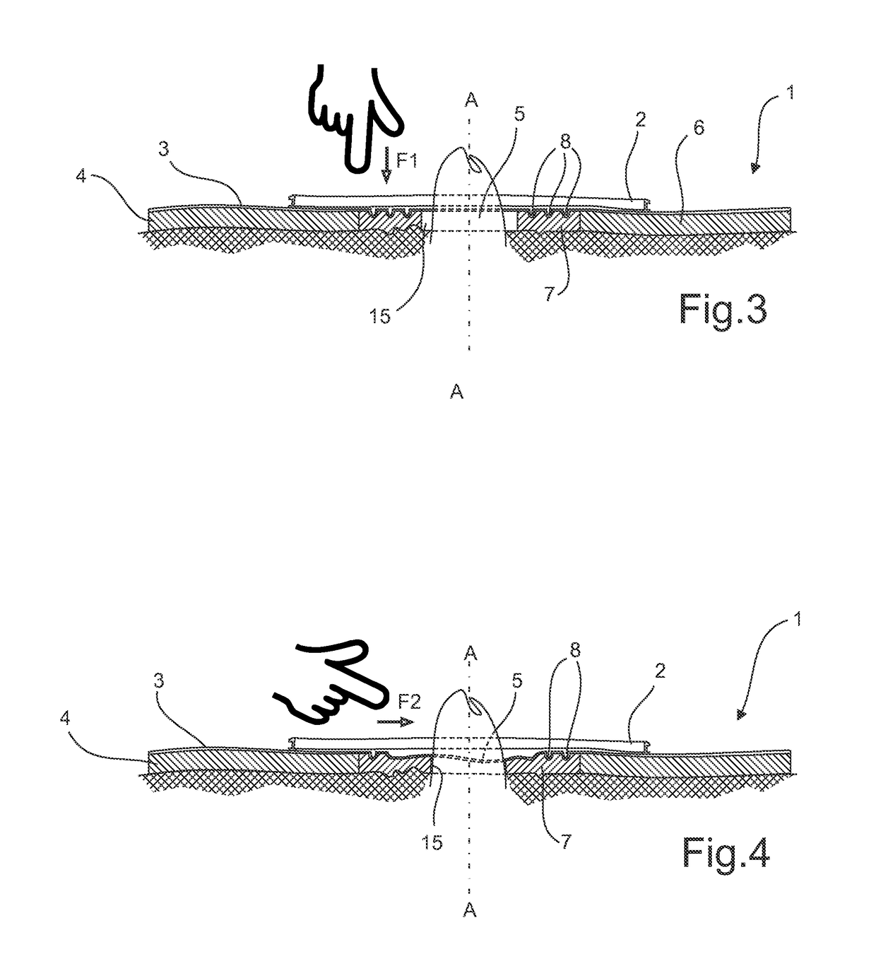 Ostomy base plate with mouldable inner adhesive