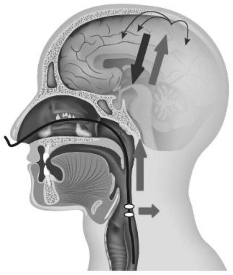 Method for treating dysphagia