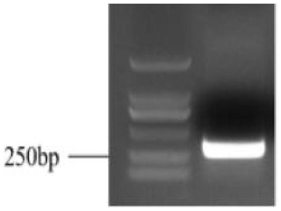 MYB transcription inhibition factor LrETC1 related to lycium ruthenicum anthocyanin synthesis and application thereof